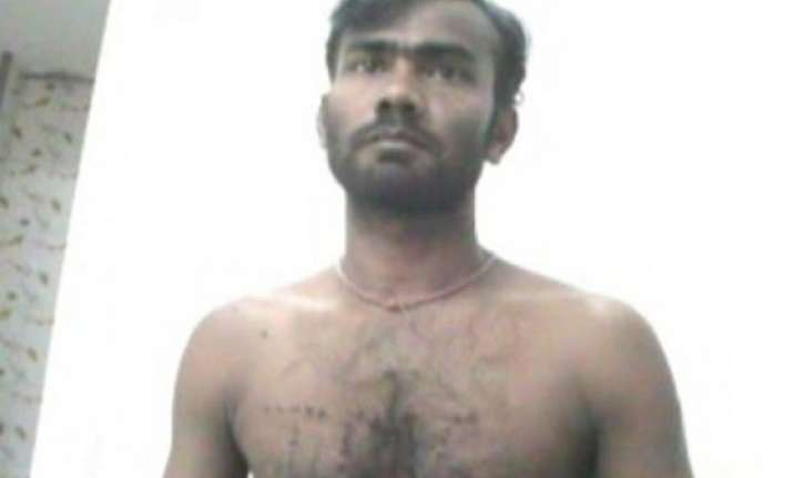 bjp worker burned with cigarette butts for attending amit