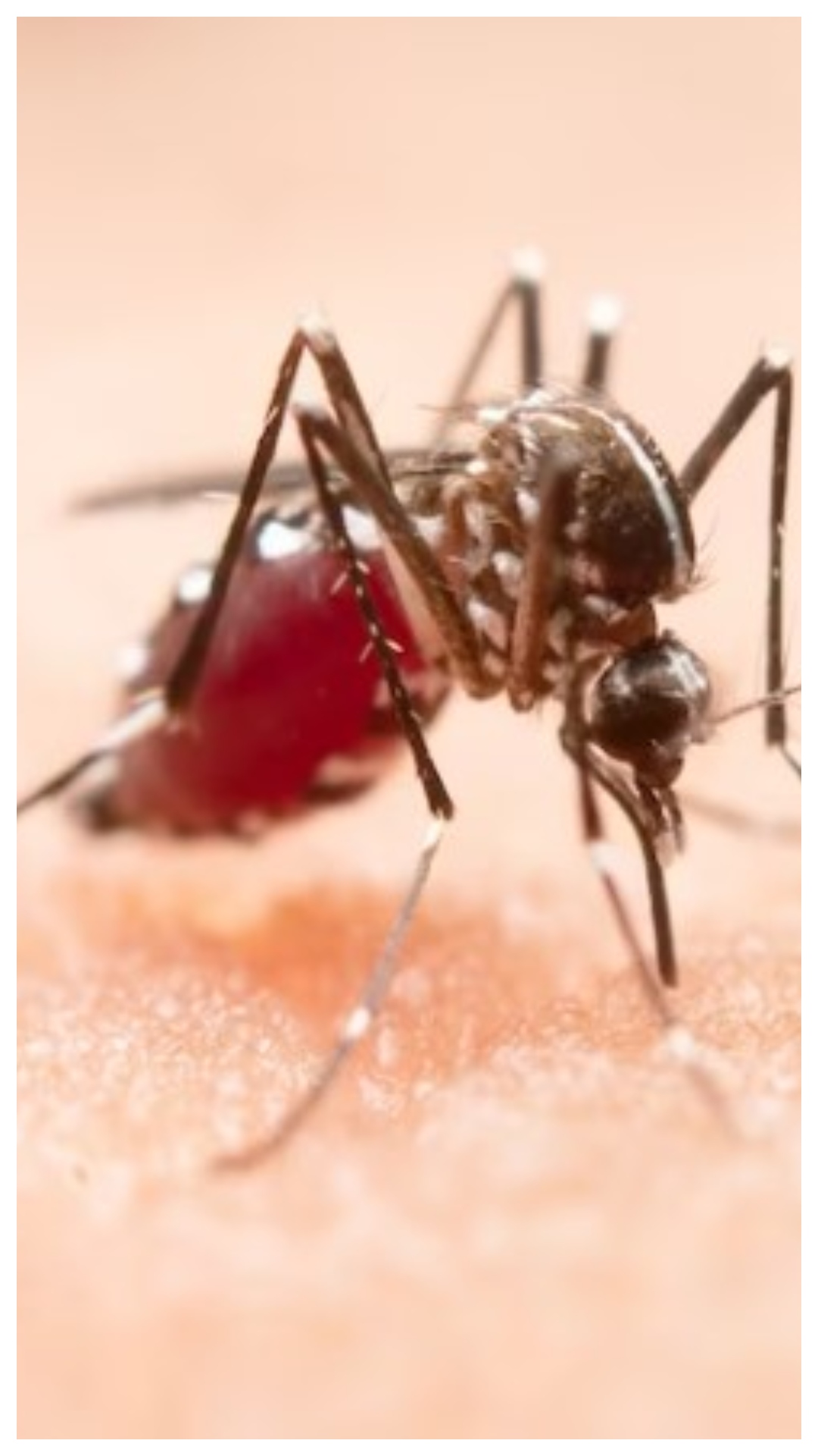 Signs and symptoms of Zika Virus
