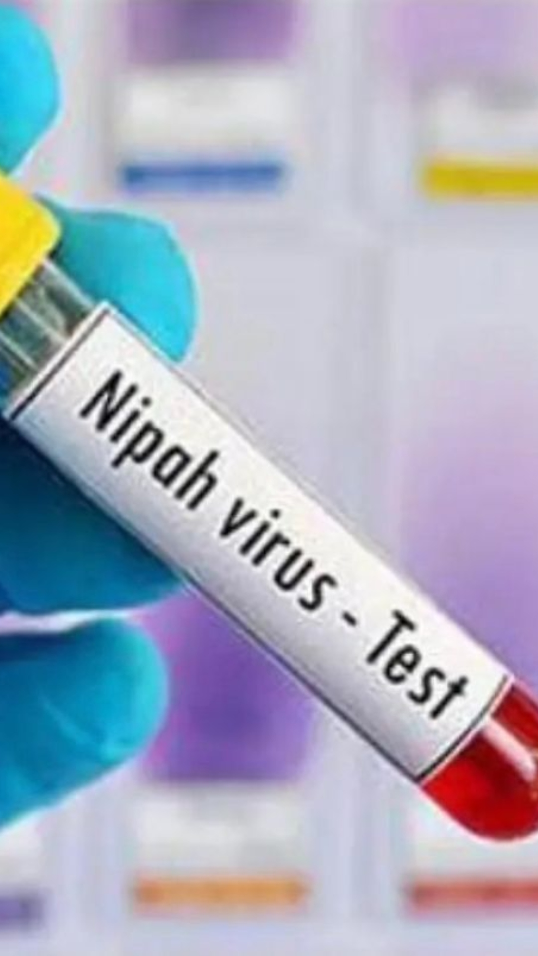 Signs and Symptoms of Nipah Virus photos