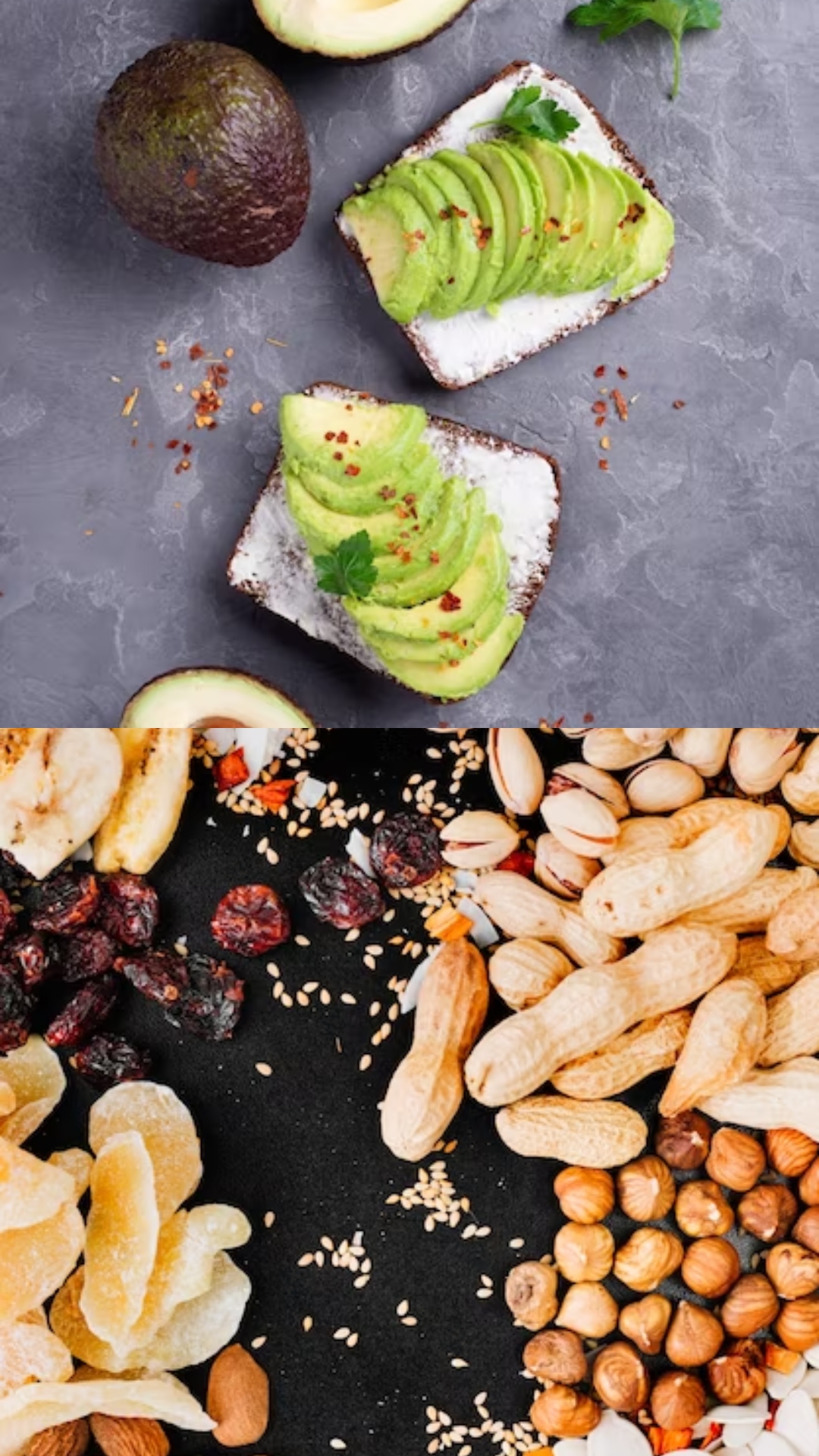 Avocados to Almonds: Foods you need in your diet to combat with dry skin during winter