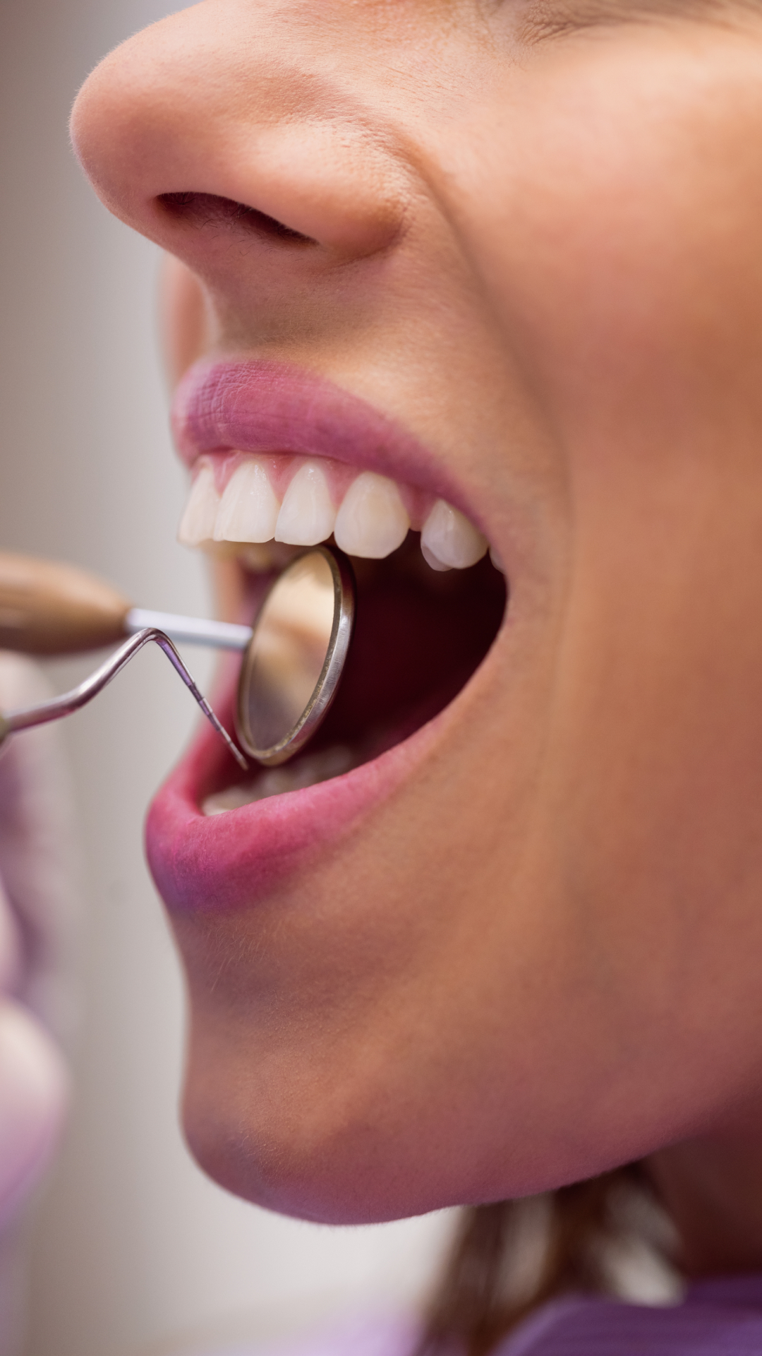 7 essential winter dental health practices