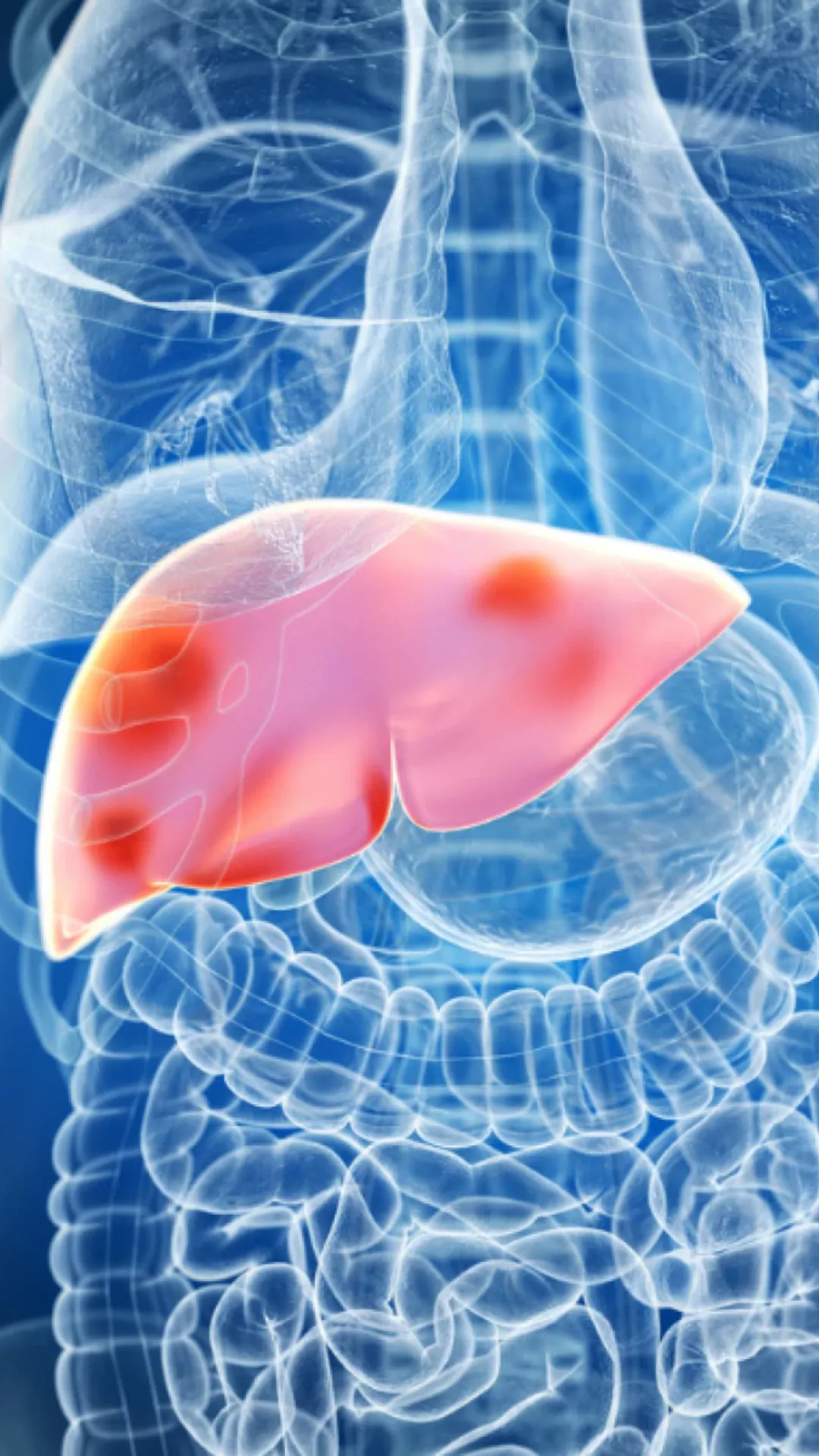 5 yoga poses to promote liver health