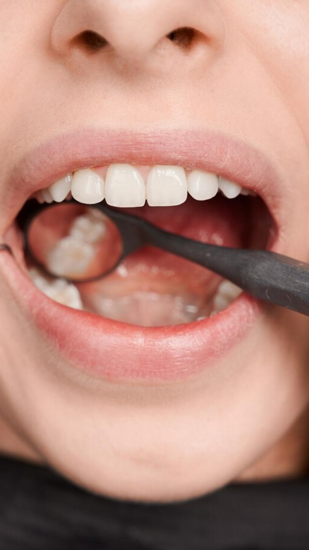 5 home remedies to treat oral injuries