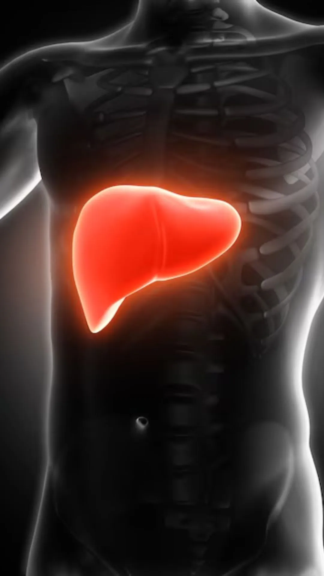 5 daily habits that cause fatty liver