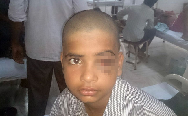 12-yr-old boy miraculously survive after metal hook pierces skull 12-yr-old boy miraculously survive after metal hook pierces skull