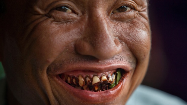 A habitual " kun-ya" eater with some betel leaves in his mouth A habitual " kun-ya" eater with some betel leaves in his mouth