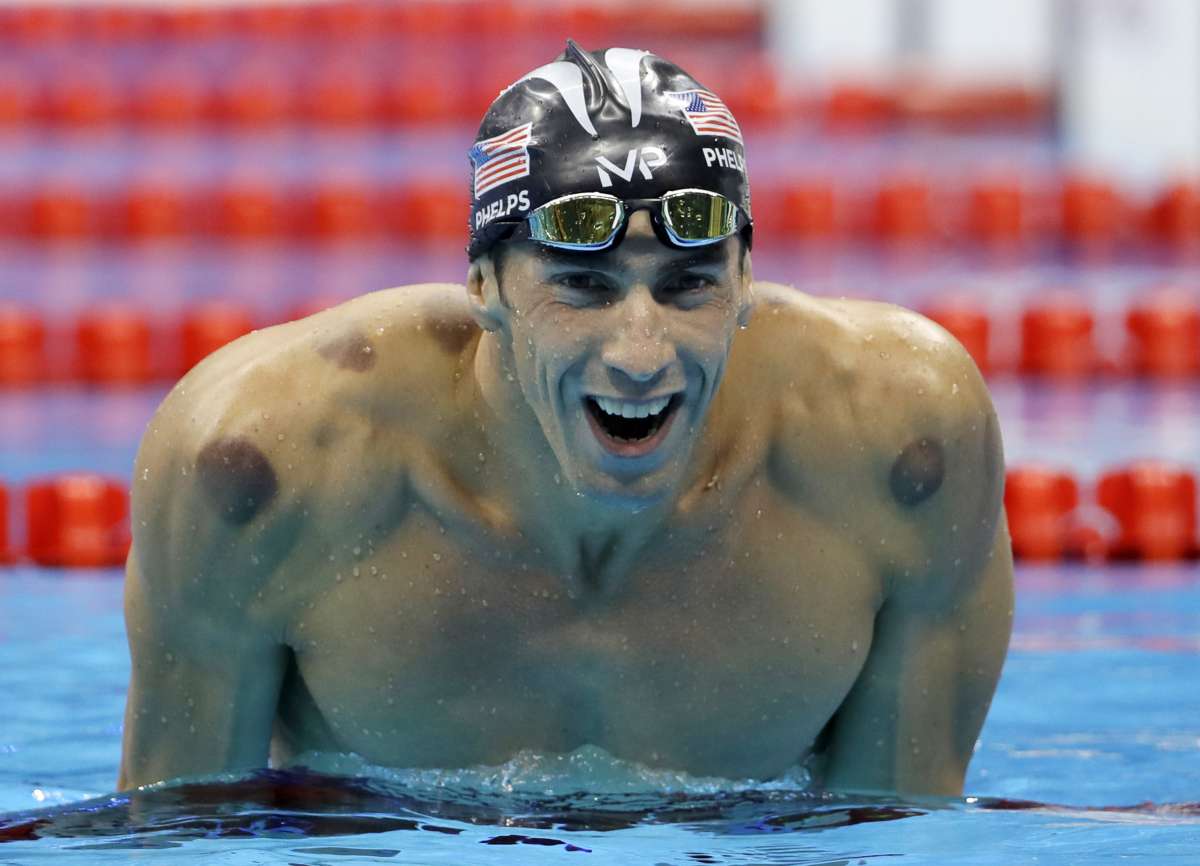 Here is why Olympian Michael Phelps has purple spots on his back India TV