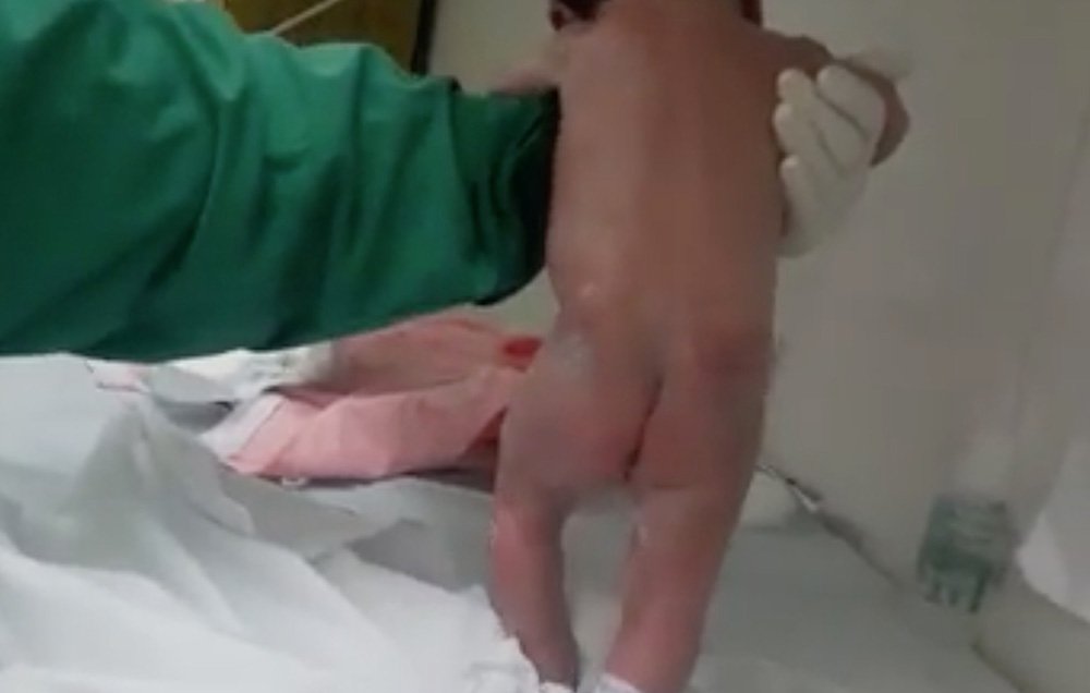 baby walking after birth viral video