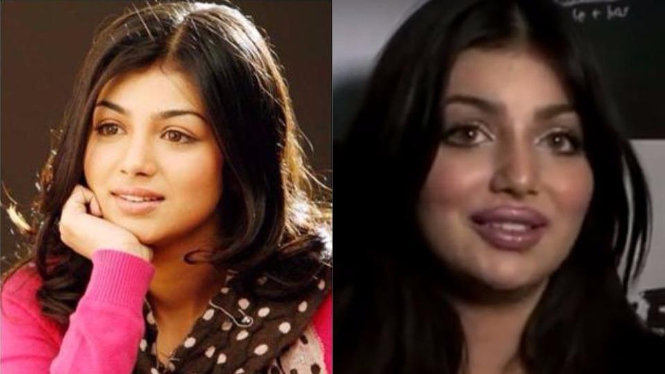 Ayesha Takiya Sex Mms - Ayesha Takia on getting botox: My pictures were morphed | Bollywood News â€“  India TV