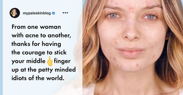 Makeup-free acne selfies are the latest Instagram thing- but why are ...