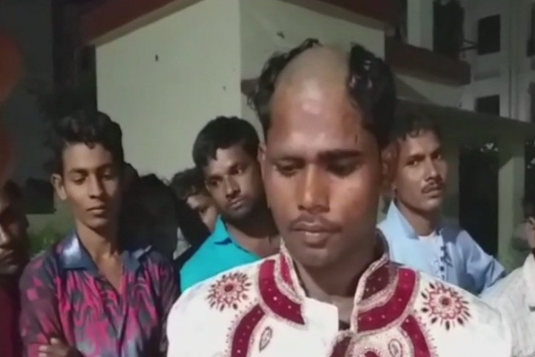 Lucknow Groom Held Hostage Head Tonsured For Refusal To Marry Brides Relatives Accuse Him 5813