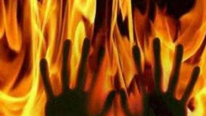 Woman set on fire by in-laws after argument over filling water