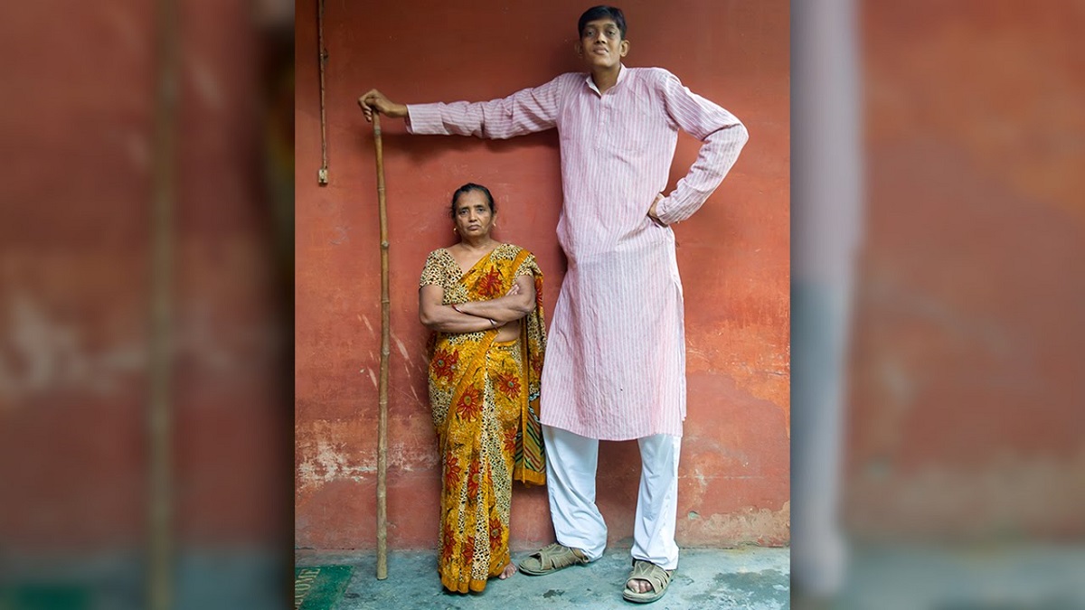 Indias Tallest Man Undergoes Successful Rare Hip Surgery In Ahmedabad