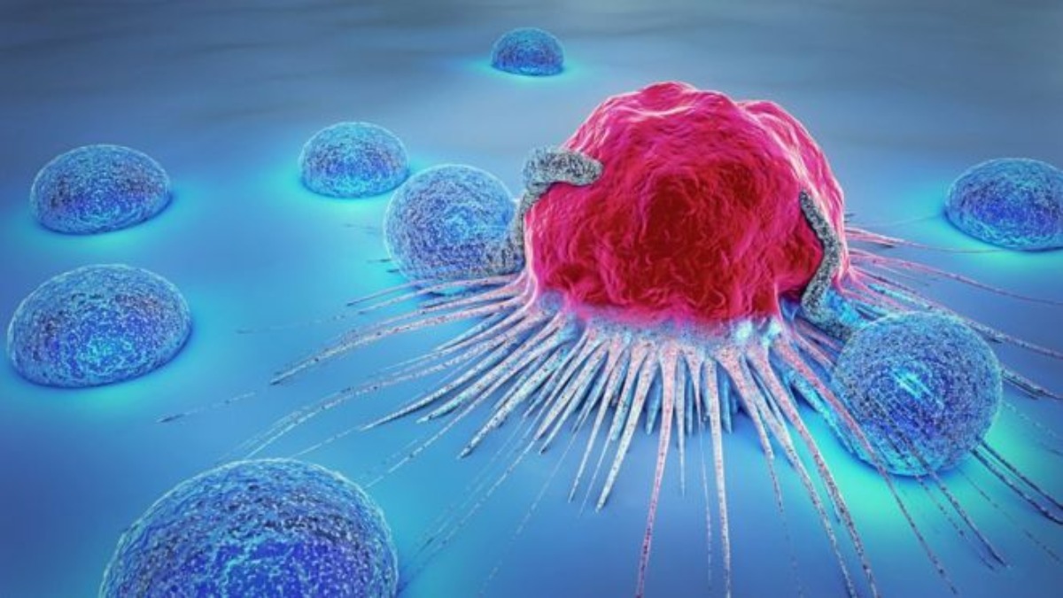 &nbsp;Artificial intelligence (AI) to help identify cancer cells using digital pathology
