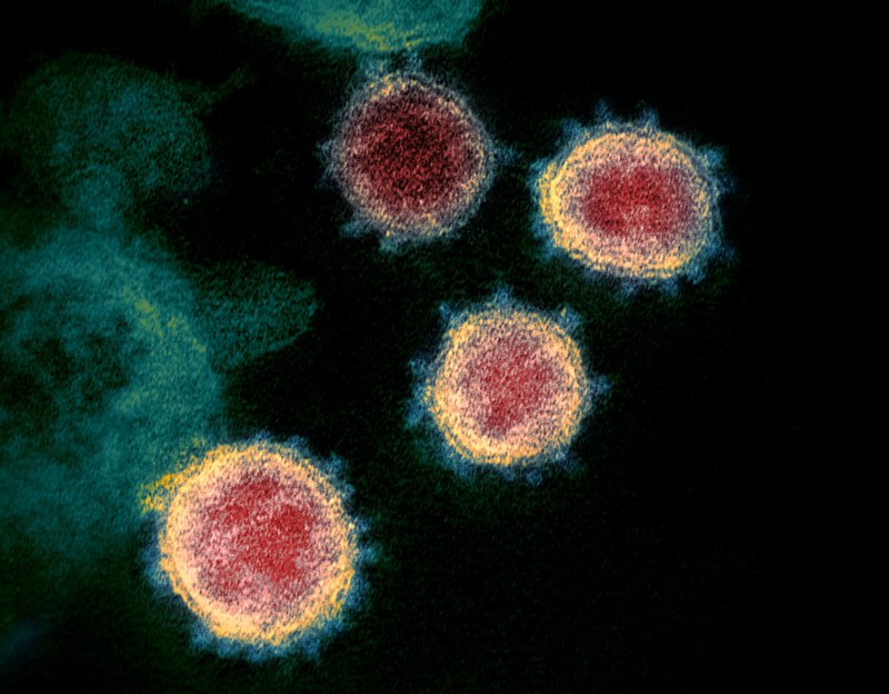 Coronavirus Impact 10 Percent Recovered Patients In Wuhan Test