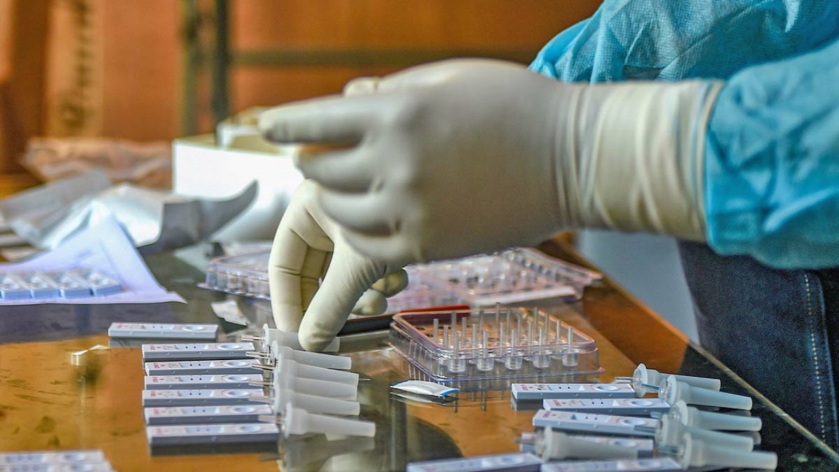 COVID19 Scientists decode how severe viral infection causes immune