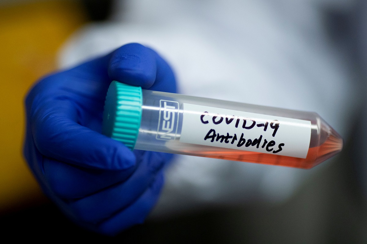 Pre-existing antibodies may protect some people against novel coronavirus, says study