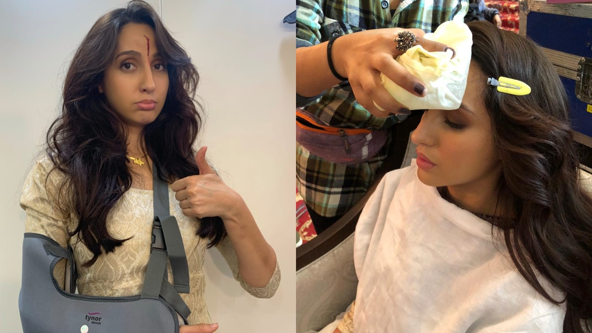 Bhuj The Pride of India: Nora Fatehi reveals she got injured while shooting an action sequence | SEE PIC