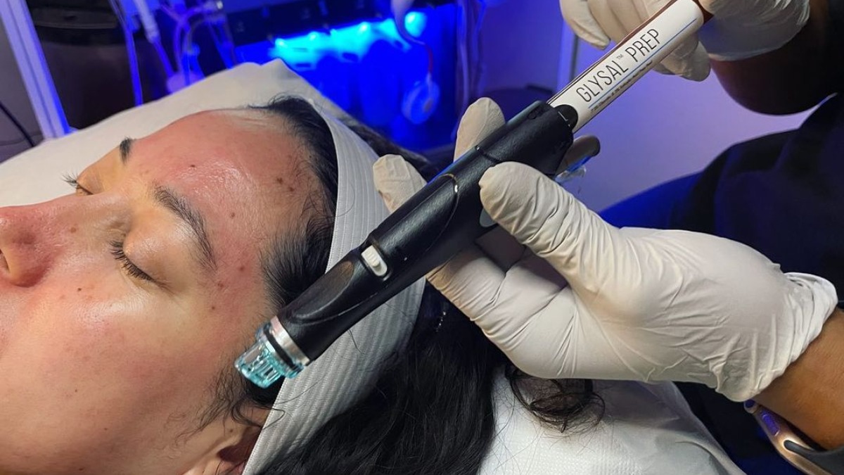 Chemical Peels To Hydrafacials Get Your Face Ready For The Wedding Season India Tv