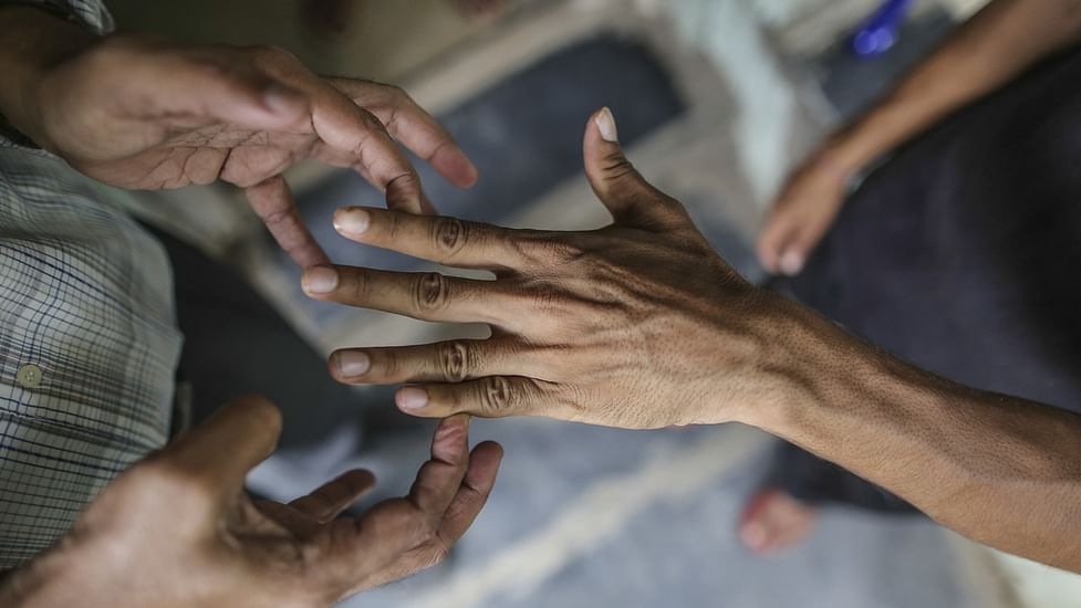 World Leprosy Day 2022: Stigma, ostracisation still haunt patients in India