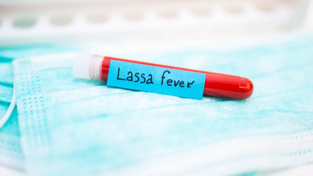 After COVID, Lassa fever creates havoc. Know its symptoms, causes and treatment