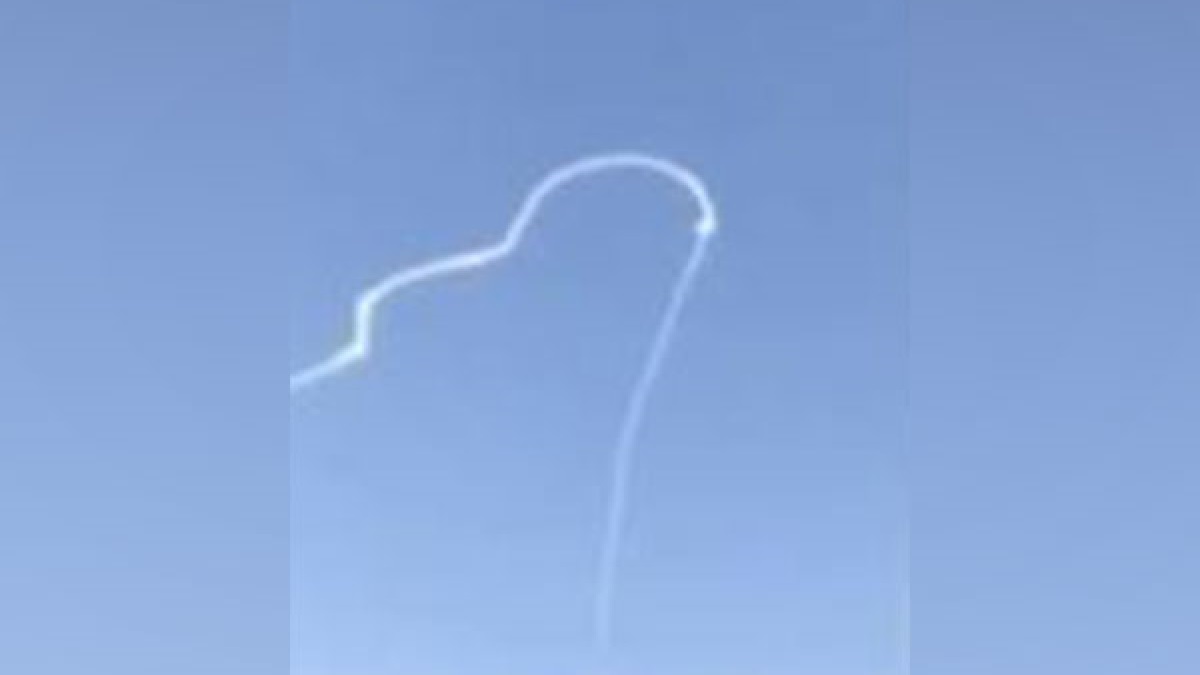 Repersentational image.