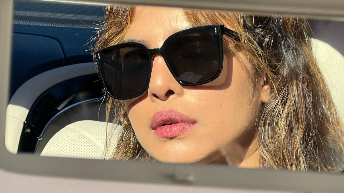 Priyanka Chopra Jonas Shares Photo Of Her Bruised Face From Citadel Set Fans Ask Are You Ok