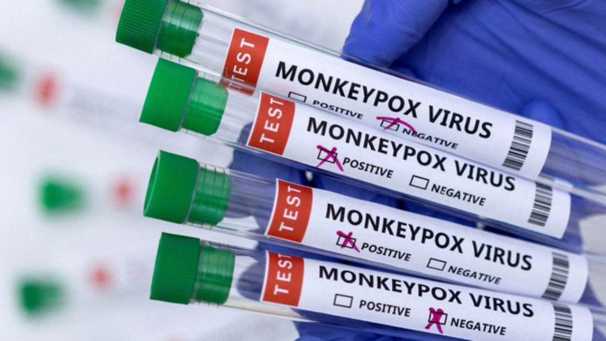 Monkeypox declared a pandemic by WHN: Ways to prevent yourself from viral infection and treatment