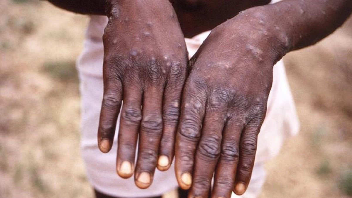 Kerala SOPs issued for isolation, sample collection, treatment of