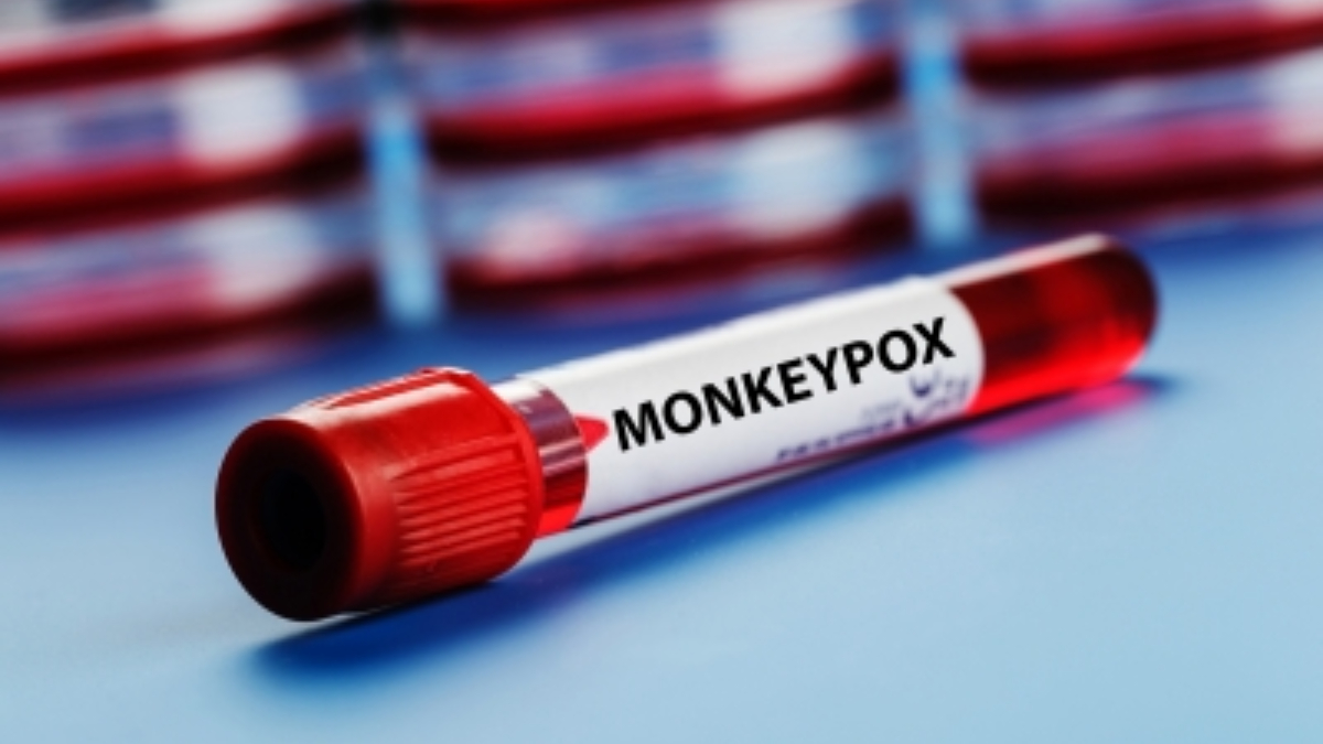 Monkeypox may not spread as fast as Covid, risk of lockdown zero US