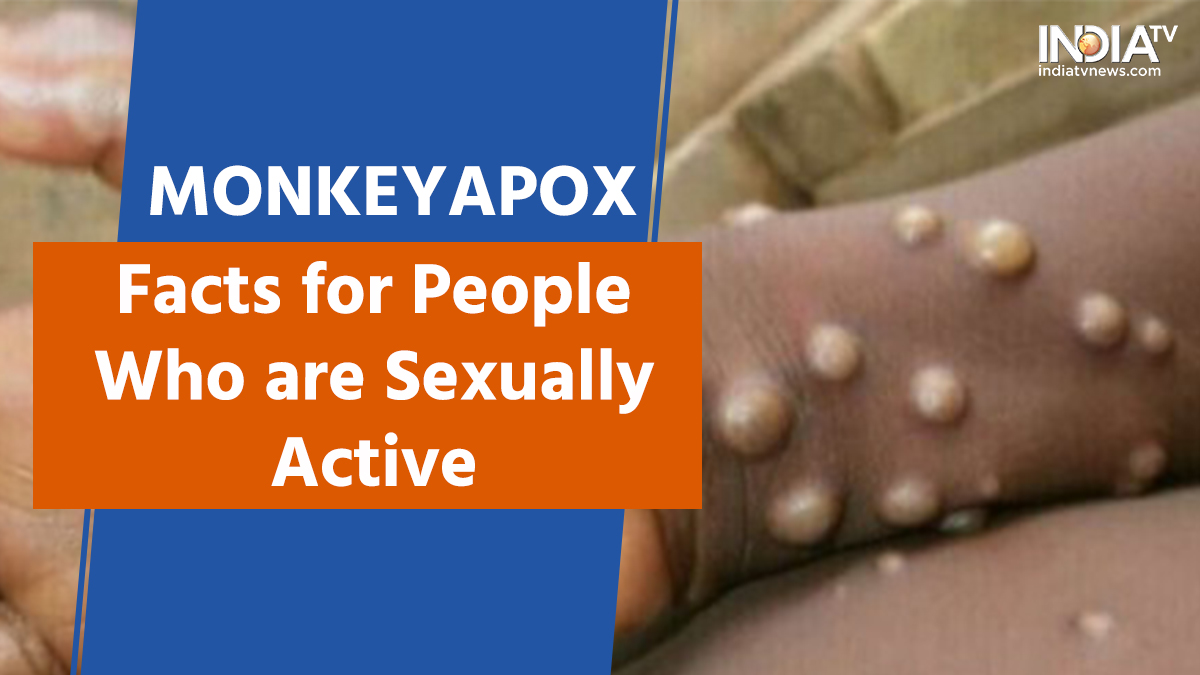 Monkeypox: 11 Facts sexually active people should know to stay protected