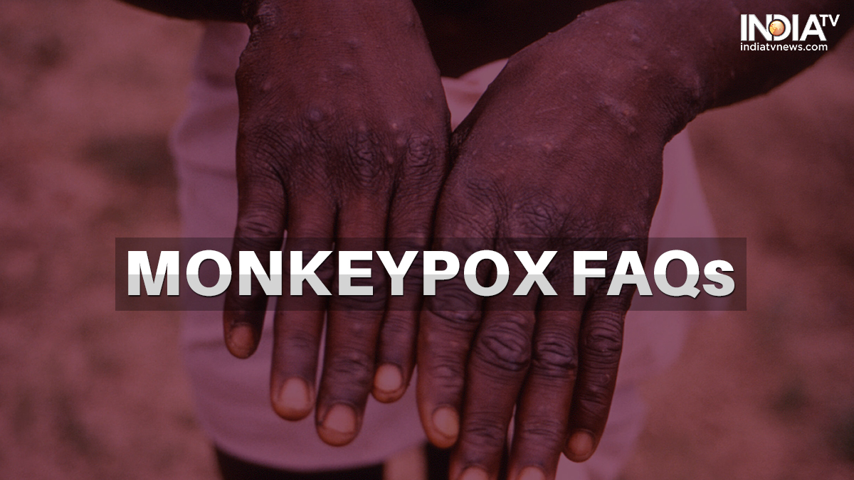 Monkeypox FAQs Are tests available for diagnosis? Is the viral disease