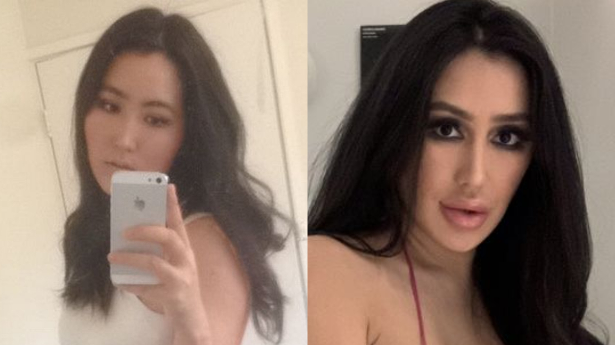 Woman spends whopping Rs 48 lakh on surgery to look like Kim Kardashian;  result will shock you | Trending News – India TV