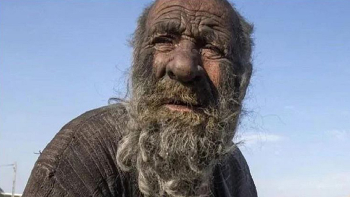 Months after first bath in over 50 years, ‘World’s dirtiest man’ dies in Iran