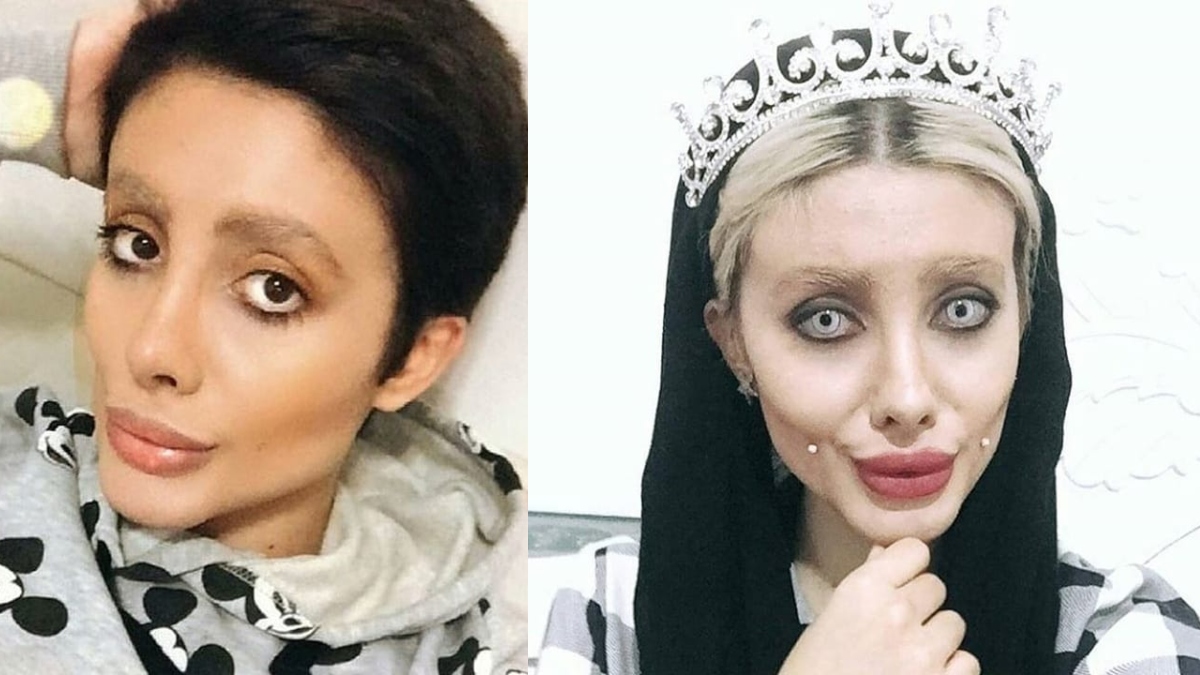 Irans Zombie Angelina Jolie Reveals Her Real Face Before Cosmetic Surgery Netizens Are