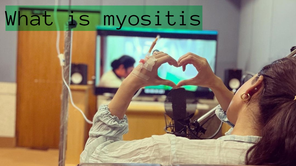 what-is-myositis-the-autoimmune-condition-samantha-ruth-prabhu-is