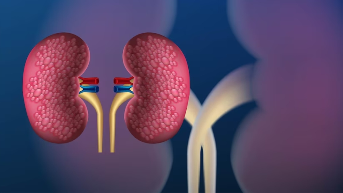 Include these five herbs in your diet to support your kidney health