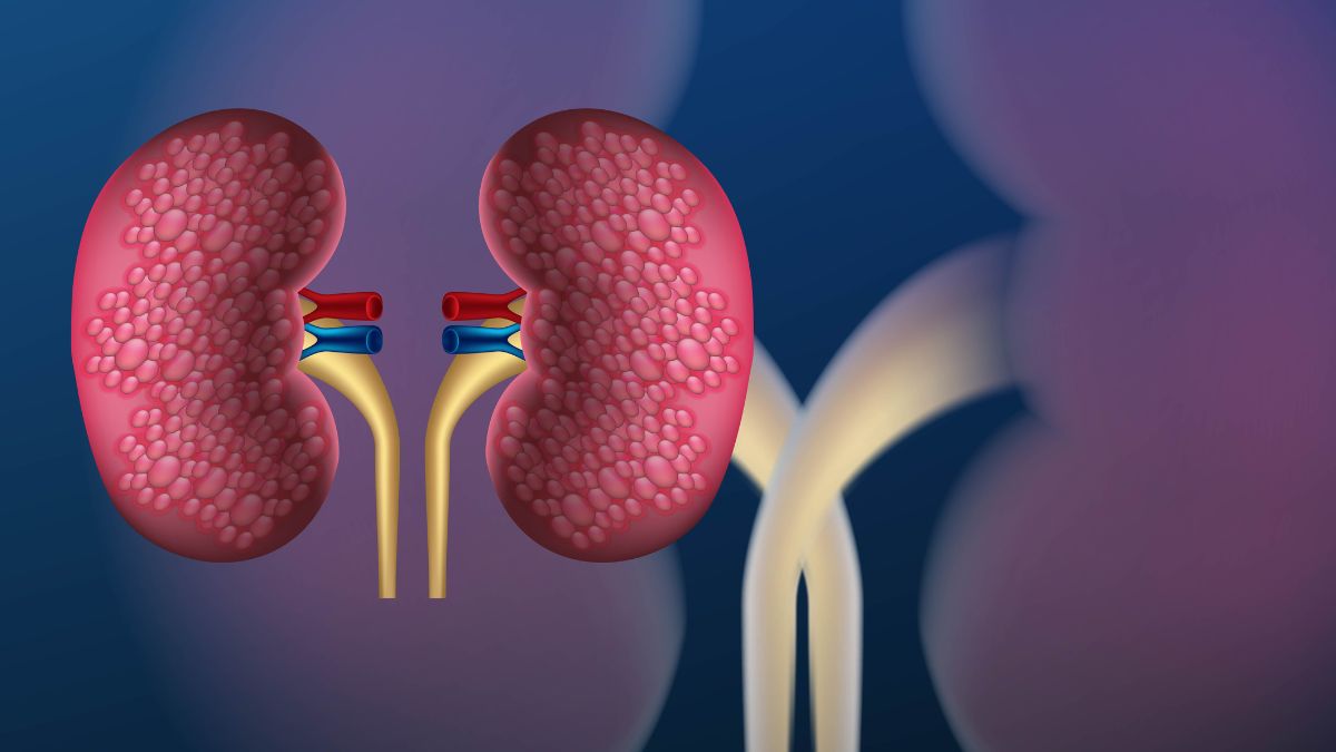 Protect your kidneys this summer: Tips for maintaining renal health and ...