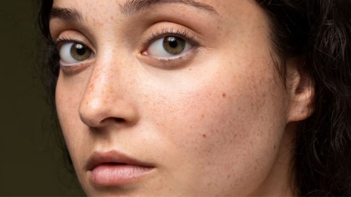 Are you dealing with open pores? These are the methods to eliminate it