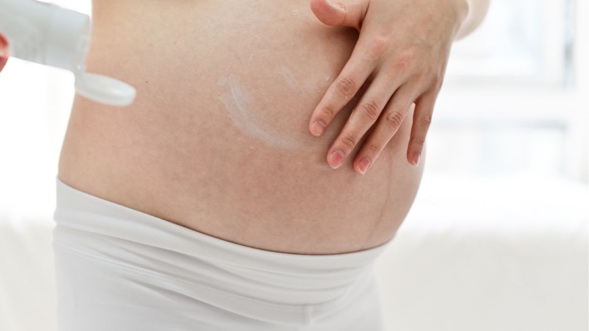 Pregnancy stretch marks: Here are some natural and effective ways to combat it