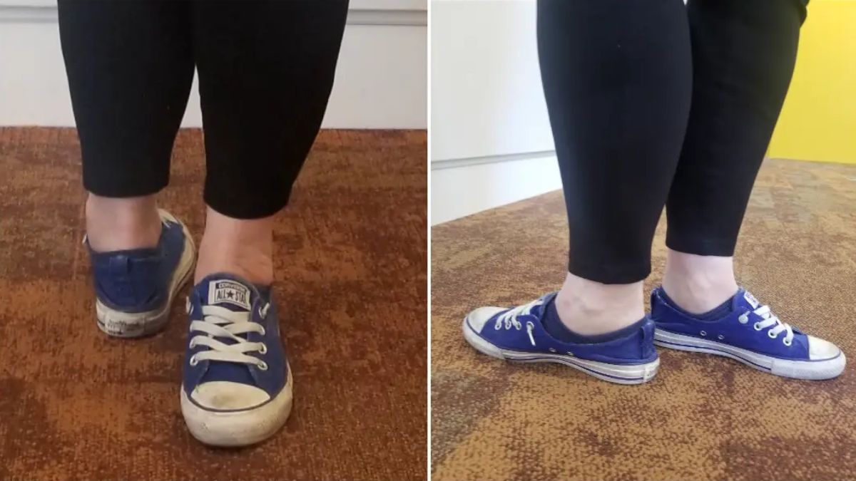 Woman breaks Guinness World record with 180-degree foot rotation