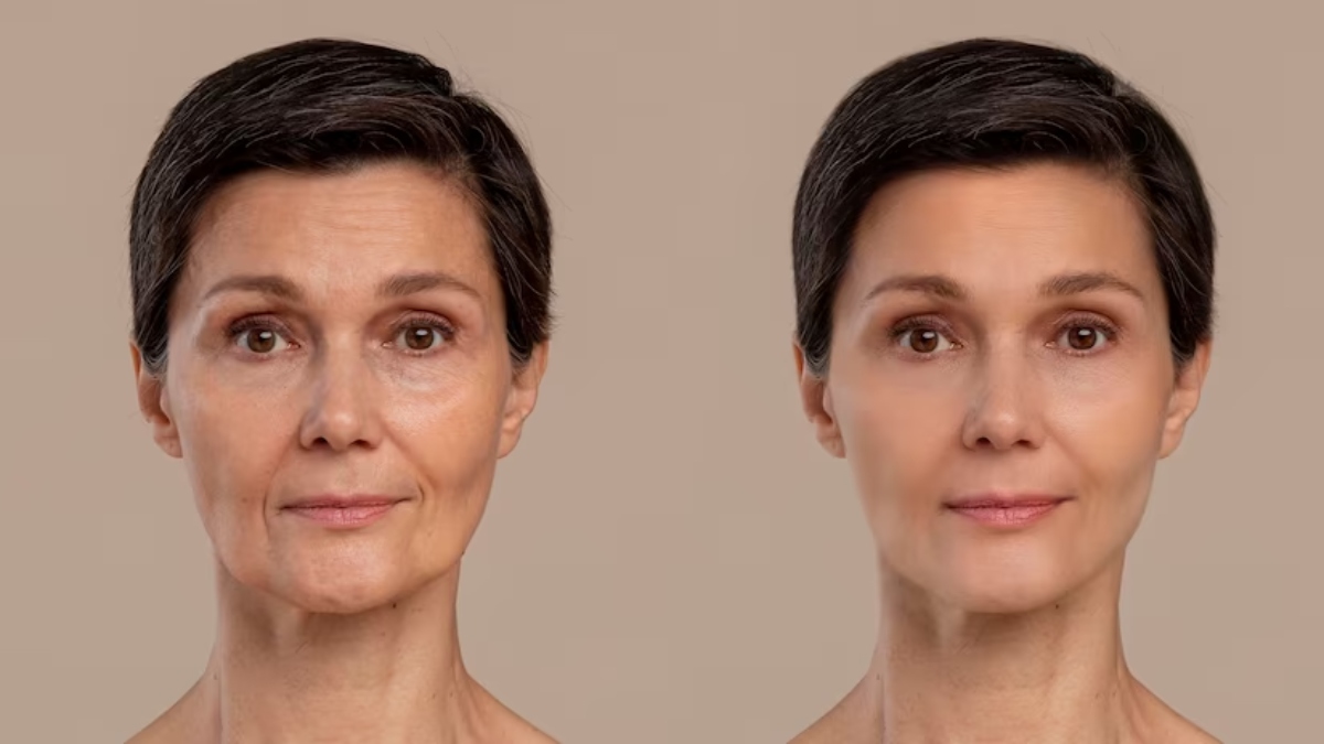 Sunlight exposure, Stress to Smoking and alcohol consumption Factors