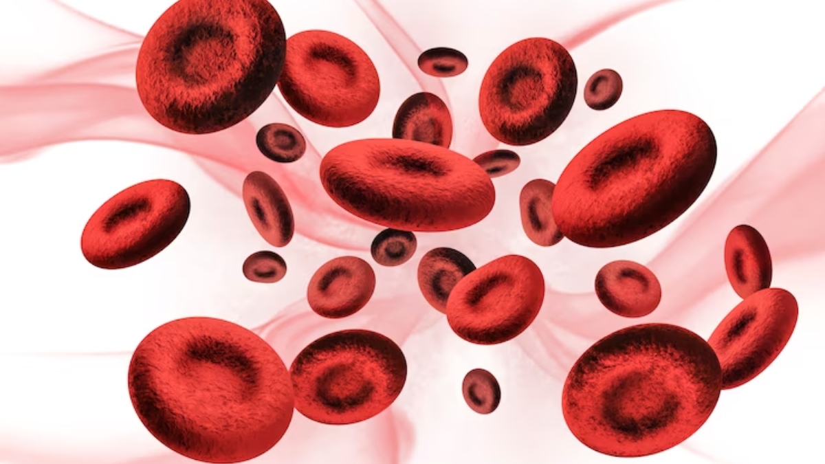 World Sickle Cell Awareness Day 2023: Know symptoms, causes and prevention of this genetic blood disorder