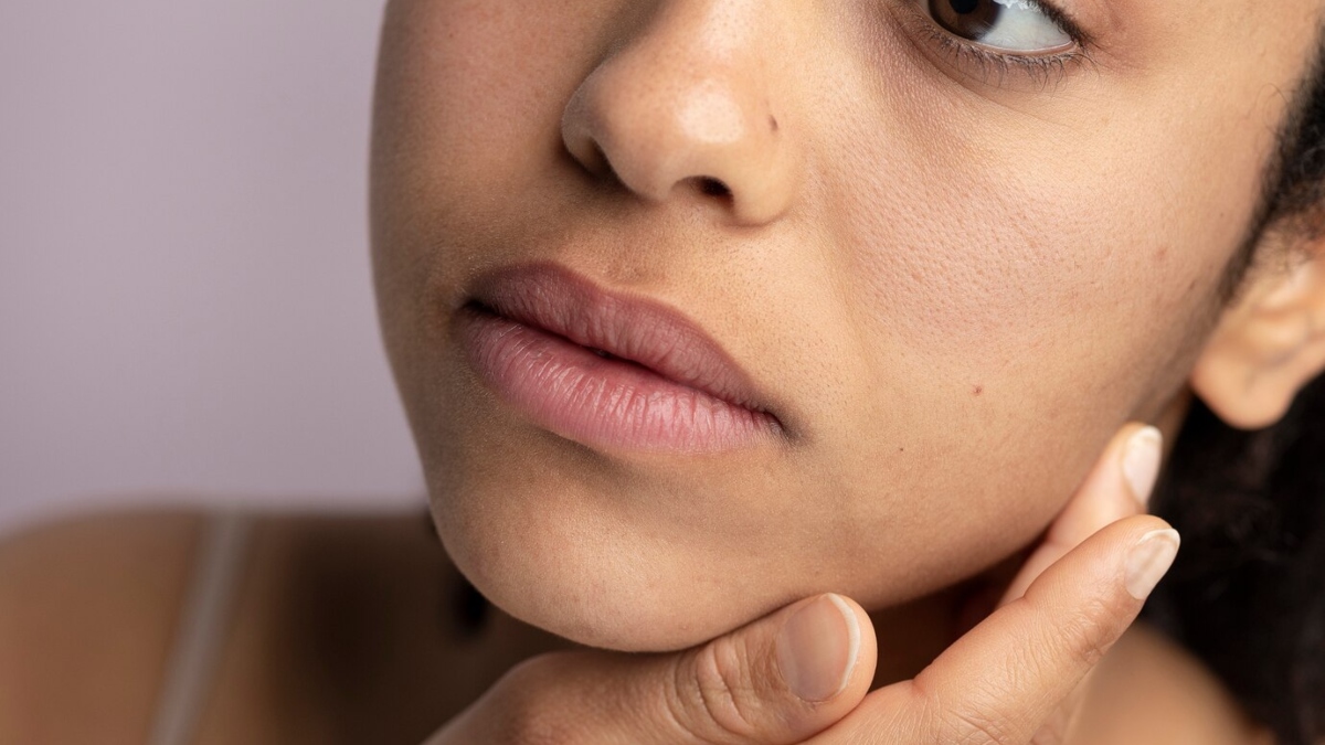 Hyperpigmentation or Melasma issues? Know the impact of air pollution on skin