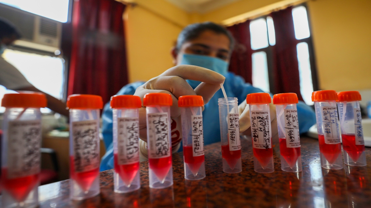 Delhi govt to send COVID samples for RT-PCR test, genome sequencing amid spike in cases