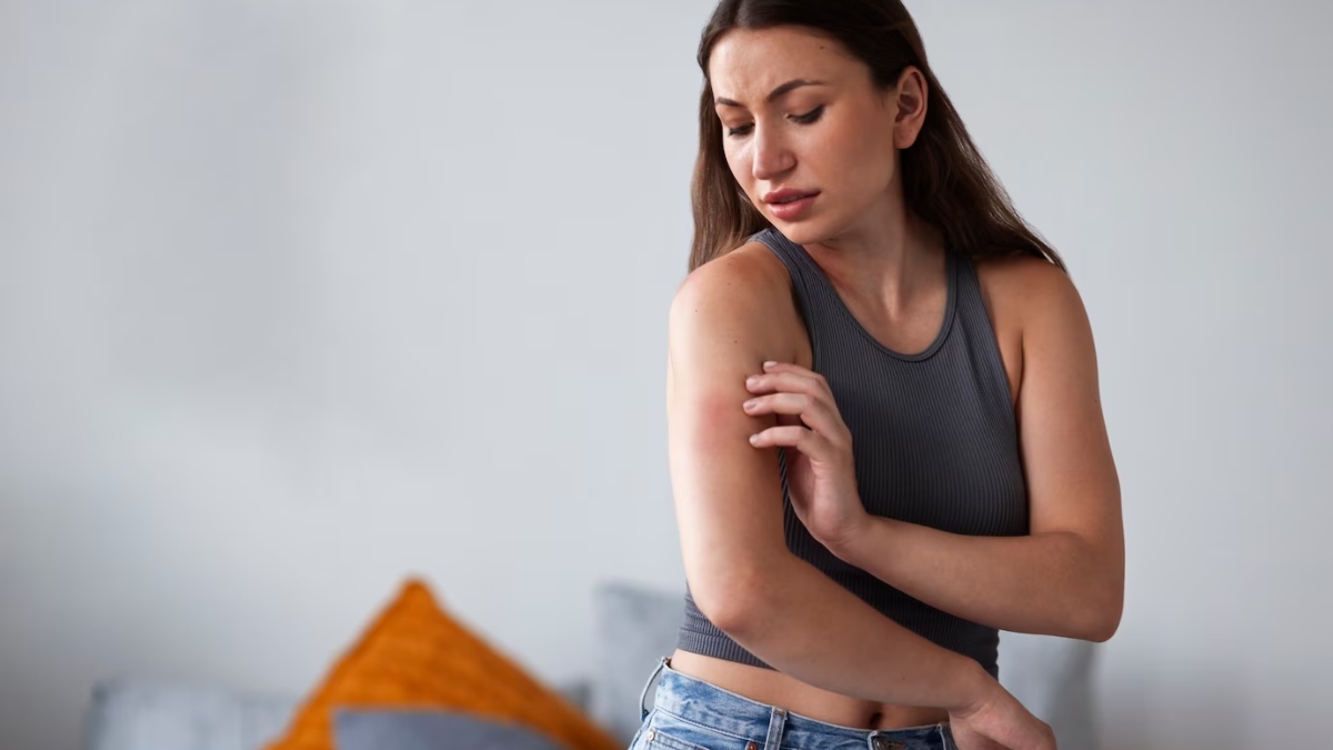 Winter Skin Diseases Holistic Approaches To Cure Eczema And Psoriasis winter-skin-diseases-holistic-approaches-to-cure-eczema-and-psoriasis