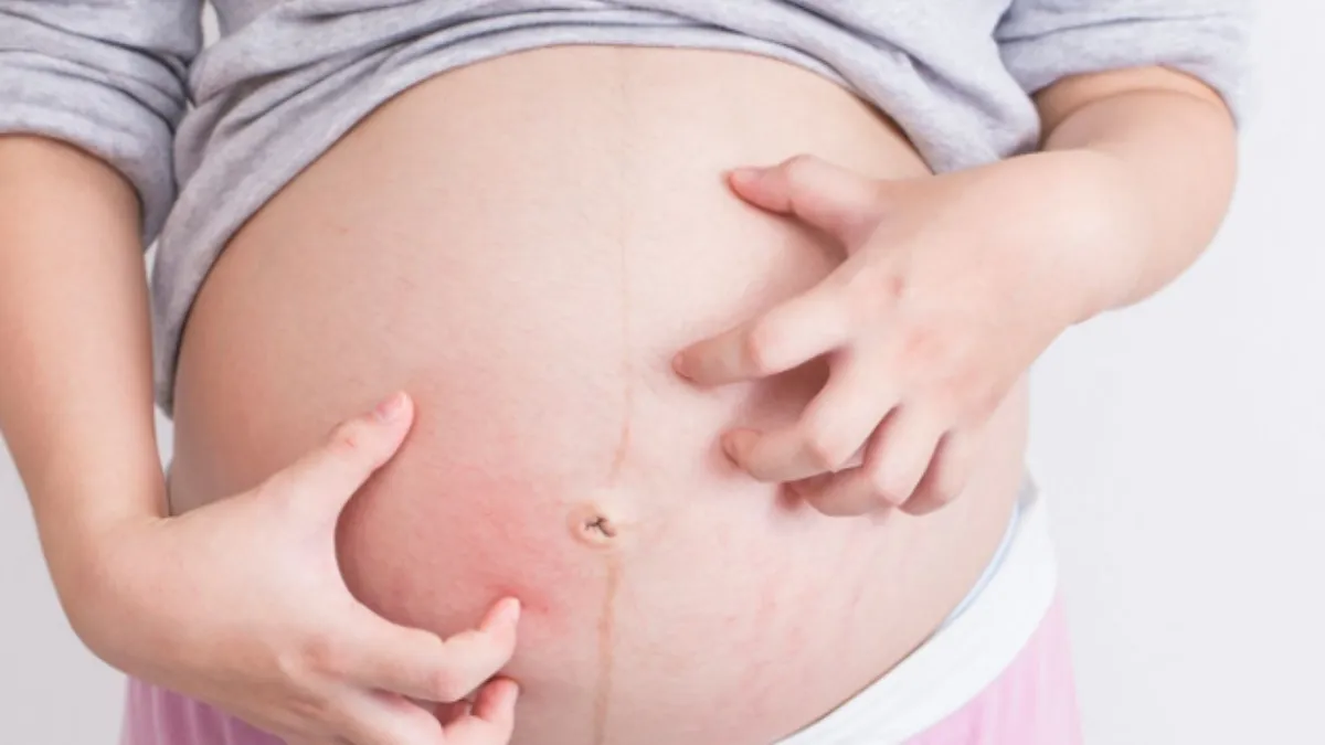 Know about the skin issues during pregnancy.