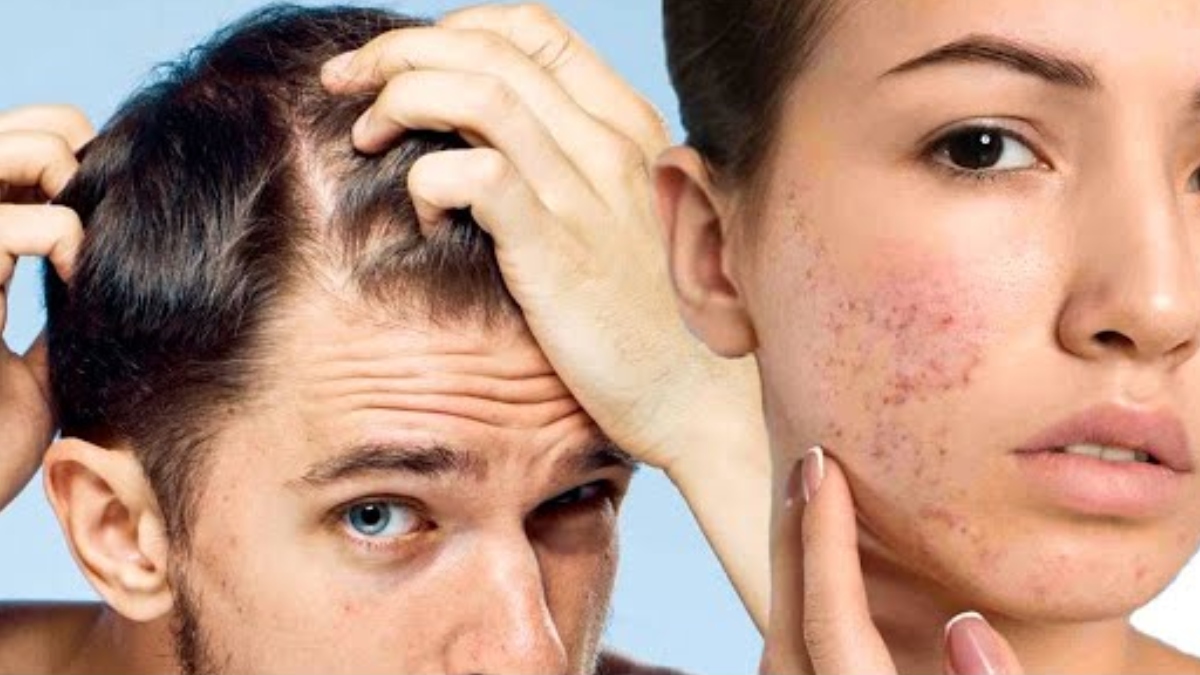 weak immunity to skin problems 5 signs of zinc deficiency you shouldn t ignore