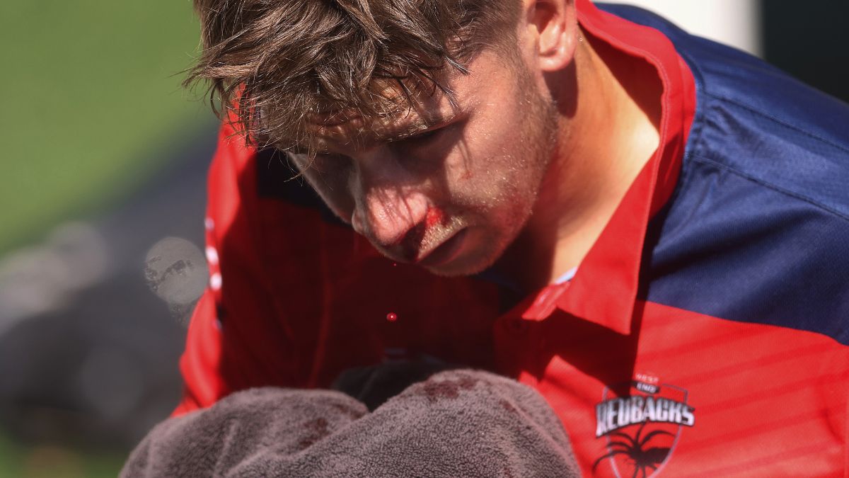 Australia cricketer Henry Hunt suffers nasty injury to nose, walks off