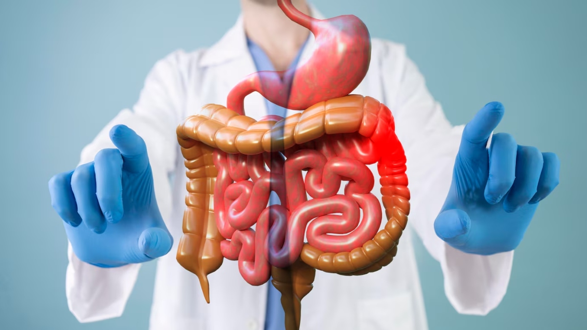 study finds why are young people more prone to colon cancer in india
